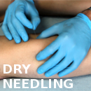 corso ECM per fisioterapisti tecnica Dry needling
